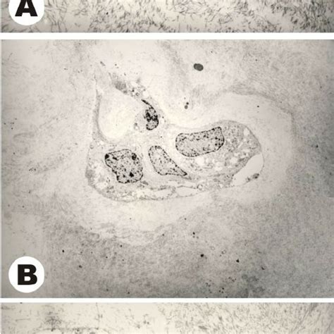 Histology And Immunohistochemistry Of Case 4 A Routine He Staining Download Scientific Diagram