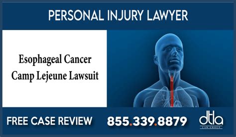 Lawyer For Esophageal Cancer Camp Lejeune Lawsuit Downtown LA Law Group