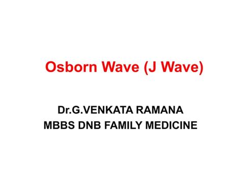 OSBORN WAVE (J Wave) IN ECG AND ITS INTERPRETATION | PPT