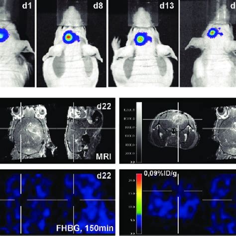 Multimodal Imaging Of Neural Progenitor Cell Migration Toward The