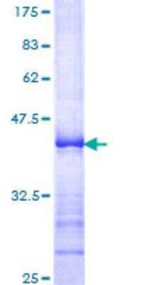 Novus Biologicals Recombinant Human Bubr Gst N Term Protein G