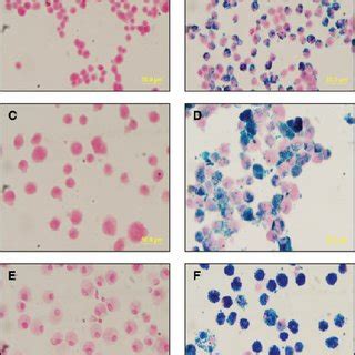 Representative Prussian Blue Photomicrographs Magnification Of