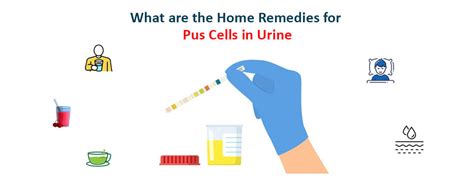 Meaning Of Urine Microscopy Pus Cells Symptoms Normal Range