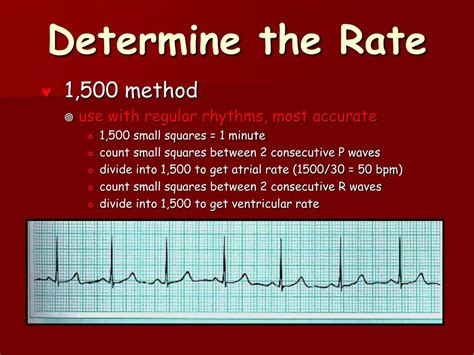 Ekg Heart Rate Calculator