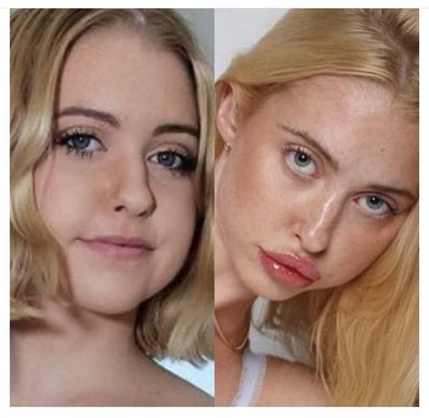 Chloe Cherry Before And After Rvindictaratecelebs