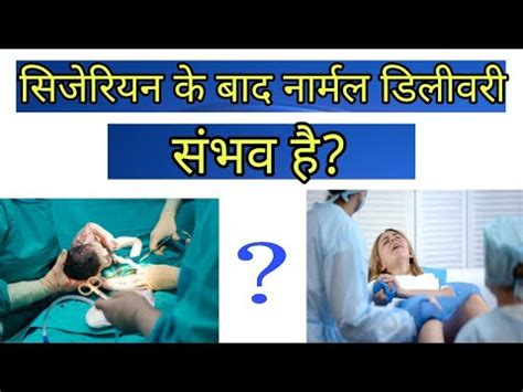 Cesarean Ke Baad Normal Delivery Ho Sakti Hai Ya Nahi YouTube