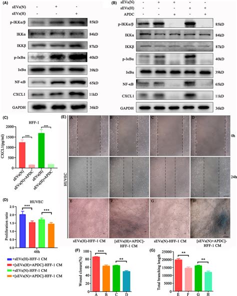 Melanomaderived Small Extracellular Vesicles Sevs Regulate Cxcl