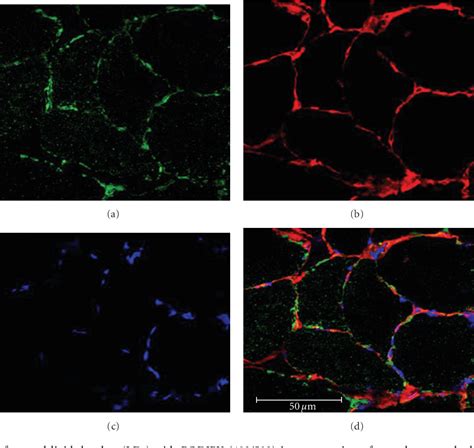 Pdf Use Of Bodipy 493503 To Visualize Intramuscular Lipid Droplets