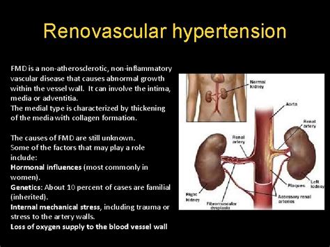 Radiology Course Peripheral Vascular Stenosis And Thrombosis Clinical