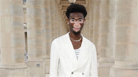 Rare Beauty: These 6 Models With Vitiligo Share How Self-Love is More ...