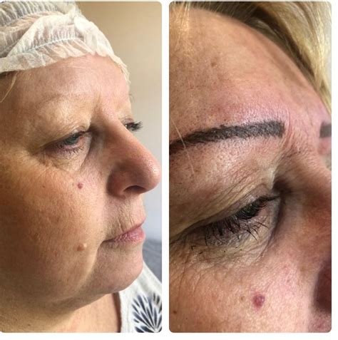 Album Semi Permanent Eyebrow Natural Enhanced Beauty Clinic Leeds