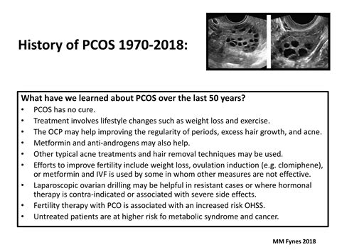 Polycystic Ovarian Syndrome Pcos Ppt