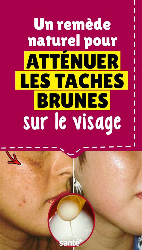 Apprenez Enlever Les T Ches De Votre Visage Naturellement En