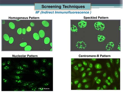 Antinuclear Antibodies by Bio-Plex 2200