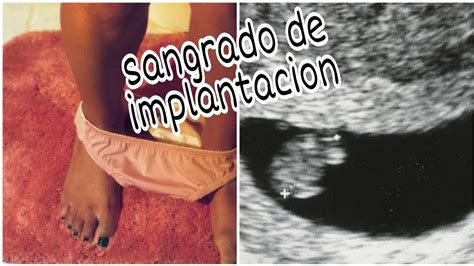 TODO SOBRE EL SANGRADO DE IMPLANTACION YouTube