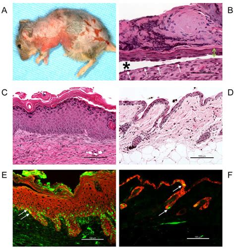 Skin Phenotype Of Adult Dsc3 Fl Fl K14 Cre Mice A A 160 Day Old