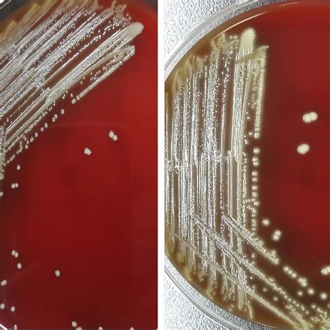 Morphology Of Blood Agar Plate Colonies Of Vagococcus Fluvialis