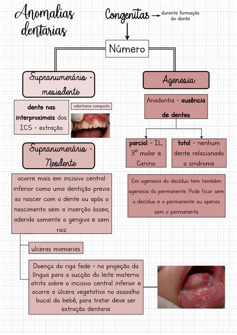 Anomalias Dentarias Odontologia Anomalias Dent Rias Congenitas