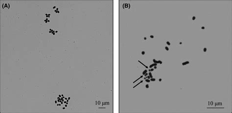 Chromosomes Of Frozen‐thawed Mouse Spermatozoa After Sonication In