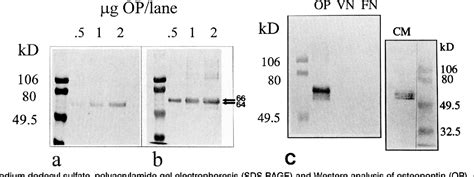 Figure 1 From Osteopontin Promotes Vascular Cell Adhesion And Spreading