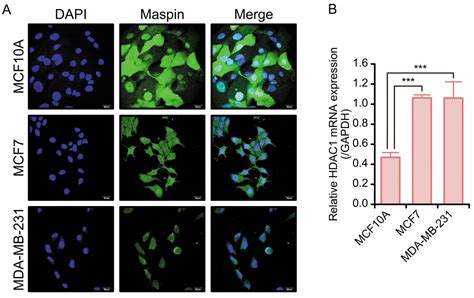 Subcellular Localization Of Maspin Correlates With Histone Deacetylase