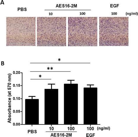 Aes M Induced Hdf Cell Migration A Transwell Migration Assay Was