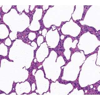 H E Staining Of Lung Tissues X A Blank Control Group B Blm