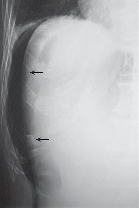 Abdomen Normal Anatomy And Examination Techniques Clinical Tree