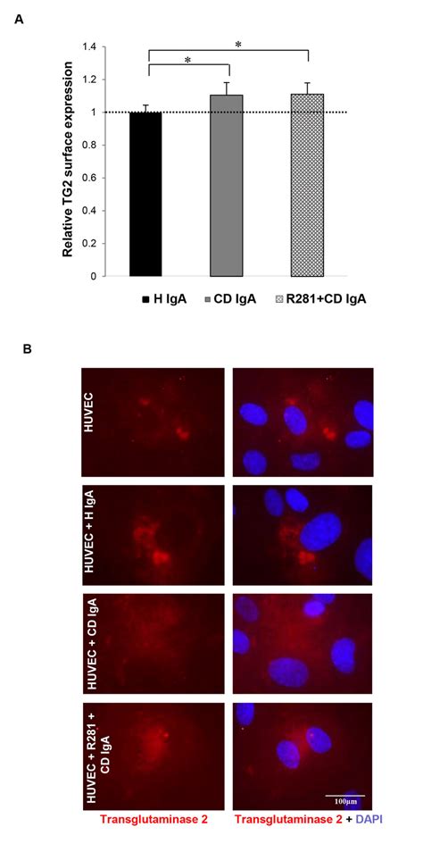 Celiac patient immunoglobulins A (CD IgA) increase transglutaminase 2 ...