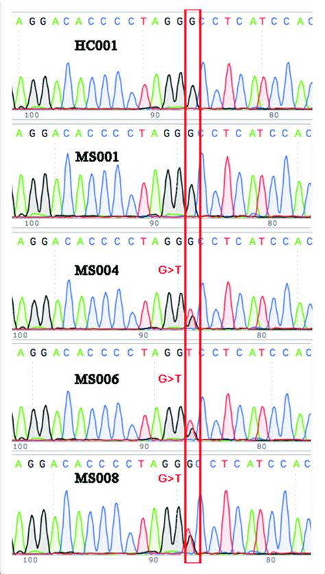 Validation Via Sanger Sequencing The G T Variant Identified In Three