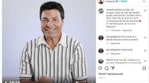 Chayanne Preocupa A Sus Fans Aparece Con Un Rostro Diferente