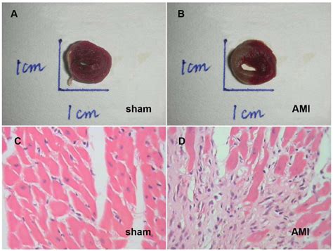 Pathohistological Manifestations Of Ami Heart Ttc Staining Showing