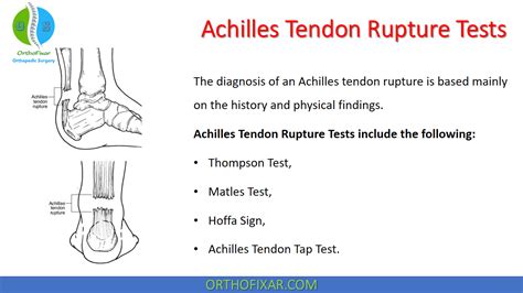 Achilles Tendon Rupture Tests | OrthoFixar 2025