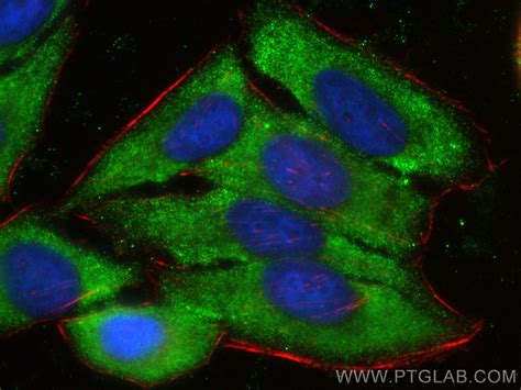 Atg Antibody Pbs Proteintech