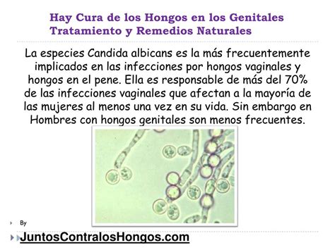 Ppt Hay Cura De Los Hongos En Los Genitales Tratamiento Y Remedios