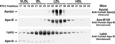 Distribution Of Apo A And Human Apob 100 In The Plasma Of Transgenic