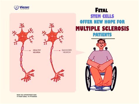 Fetal Stem Cells Offer New Hope For Multiple Sclerosis Patients