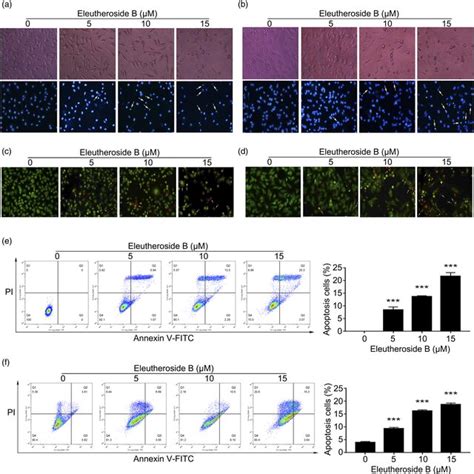 Apoptosis Of Smmc And Hela Cells Induced By Different