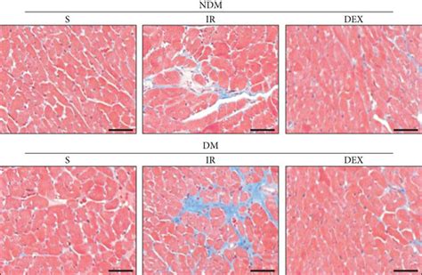 Dex Reduces Myocardial Infarct Size In Rats Myocardial Infarct Size