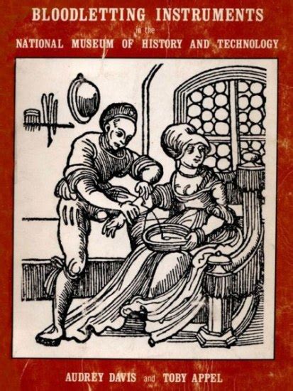 The Project Gutenberg Ebook Of Bloodletting Instruments In The National