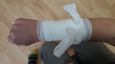 Bandaged Arm - Pochat Training