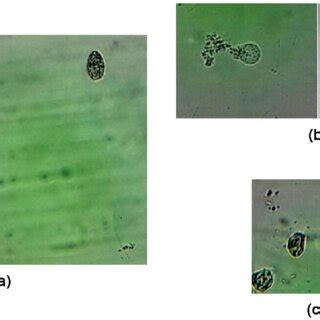 Microscopic image of Tetrahymena thermophila in PPYE medium (×10). CV ...