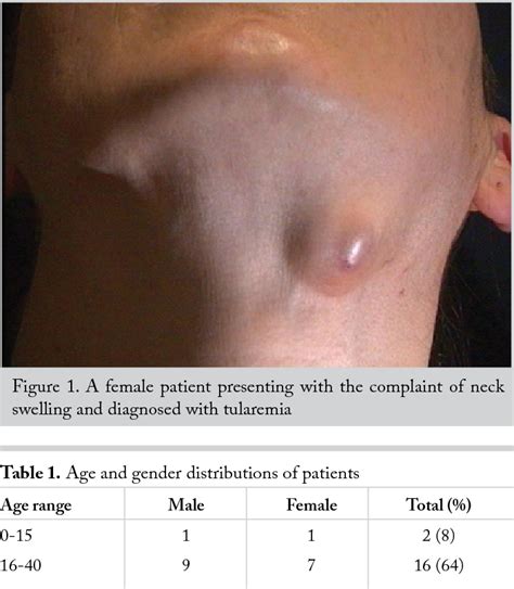 Figure From Tularemia A Rare Cause Of Neck Mass Semantic Scholar