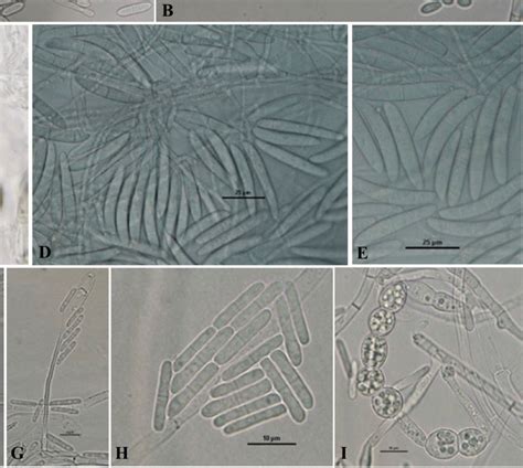 A Conidiophores Of I Liriodendri B Macro And Microconidia Of