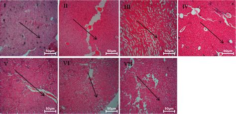 Evaluation Of Antimalarial Activity Of Ethanolic Extract Of Annona