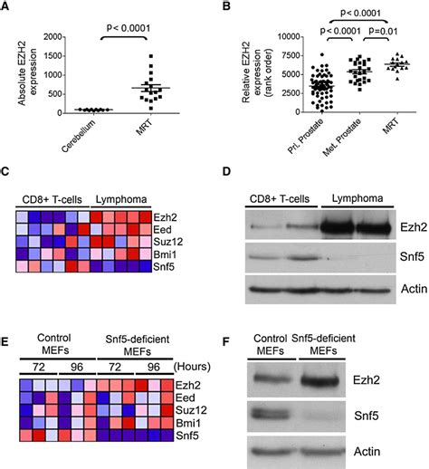 Figure 1 From Epigenetic Antagonism Between Polycomb And SWI SNF