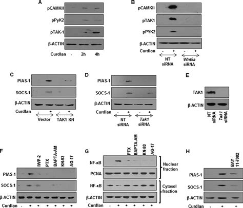 Wnt A Ca Camkii Signaling Axis Regulates Dectin Induced Pias And