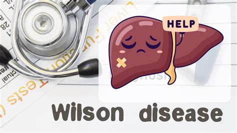 Wilsons Disease Causes Symptoms Diagnosis And Treatment