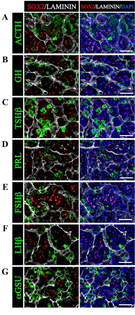 Figure 4 From Localization Of Sox2 Positive Stem Progenitor Cells In