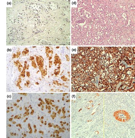 Histological And Immunohistochemical Characteristics Of The Breast